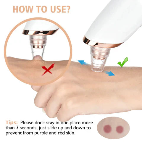 Premium Quality 5 IN 1 Blackheads Remover Vacuum Rechargable